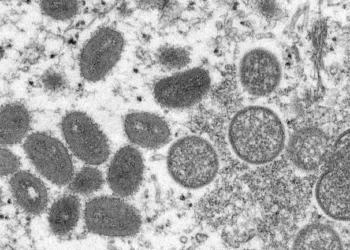 Oval shaped moneybox virus observed under electron microscope