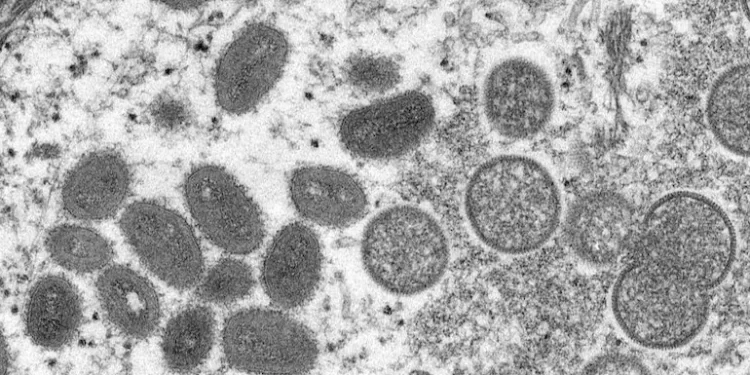 Oval shaped moneybox virus observed under electron microscope