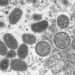 Oval shaped moneybox virus observed under electron microscope